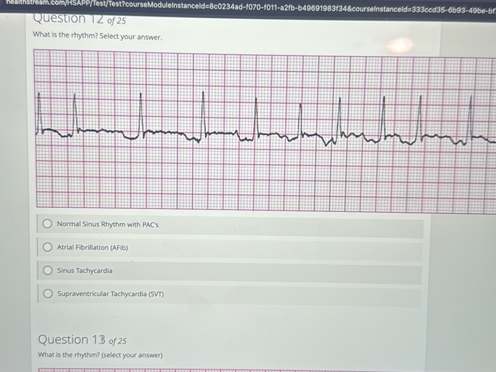 Question 12 of 25 What is the rhythm? Select | StudyX
