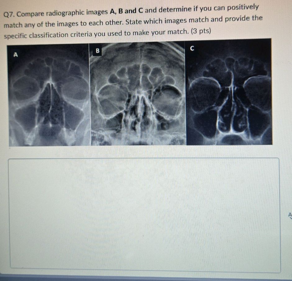 Q7. Compare radiographic images A, B and C