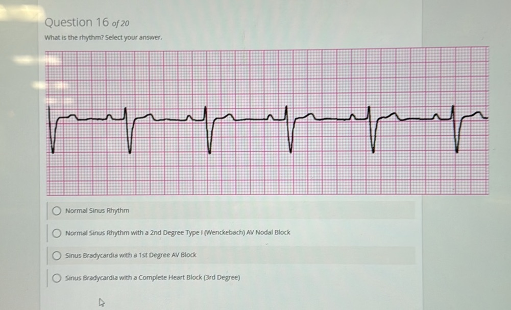 Question 16 of 20 What is the rhythm? Select | StudyX
