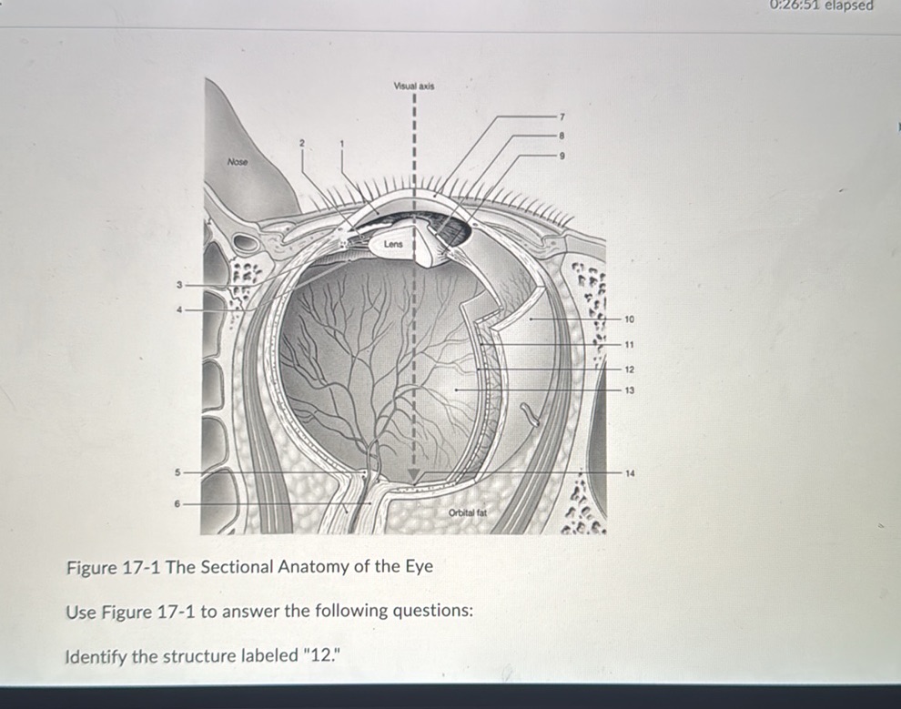 Figure 17-1 The Sectional Anatomy of the Eye