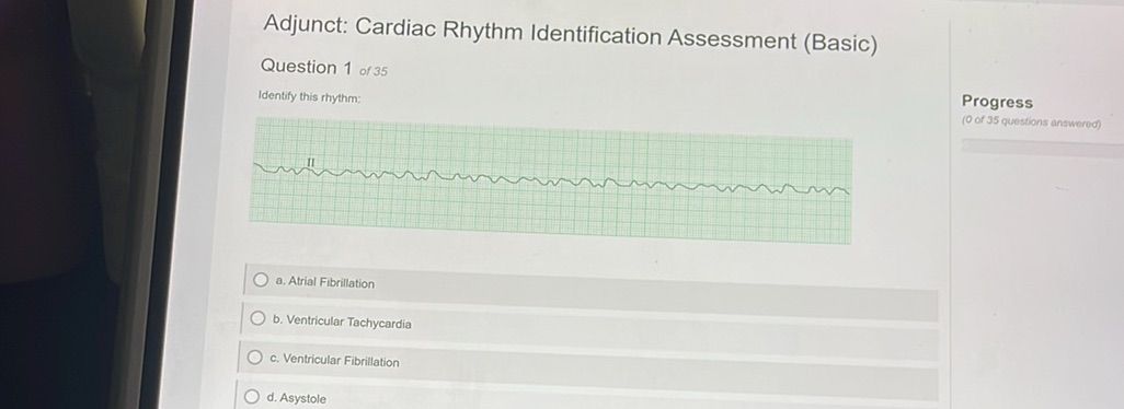 Adjunct: Cardiac Rhythm Identification | StudyX