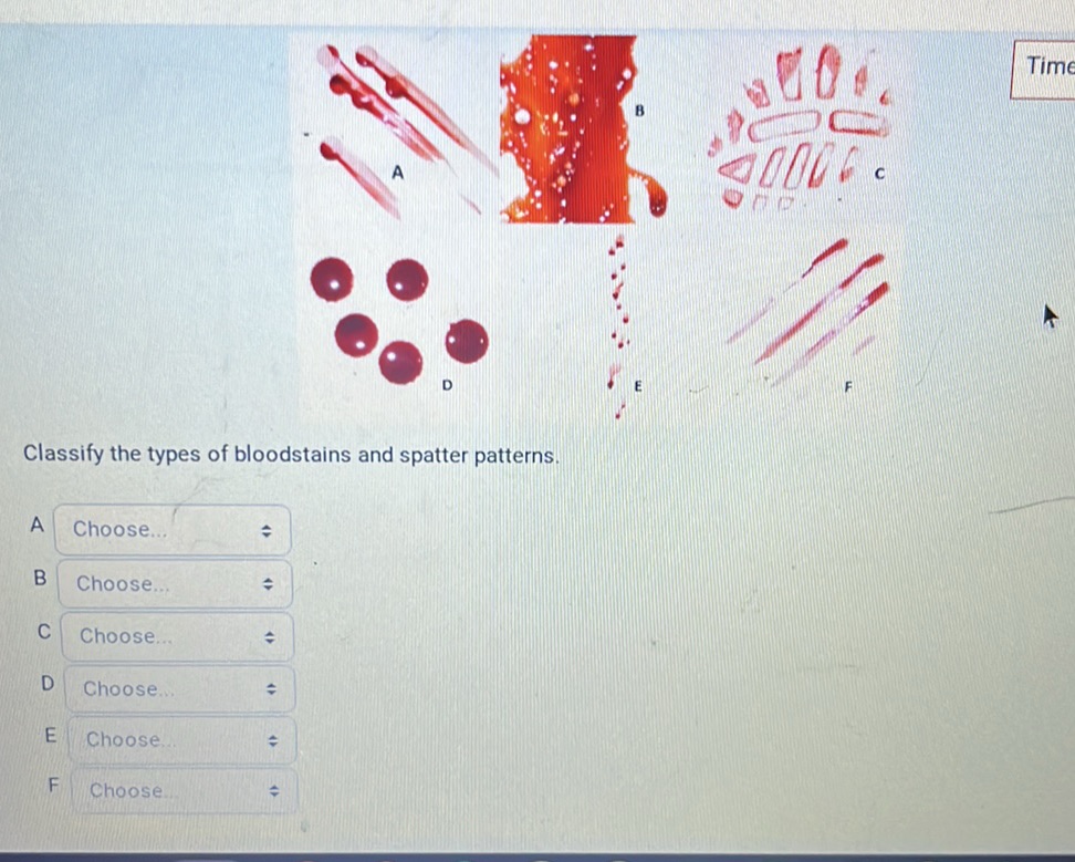 Classify the types of bloodstains and | StudyX