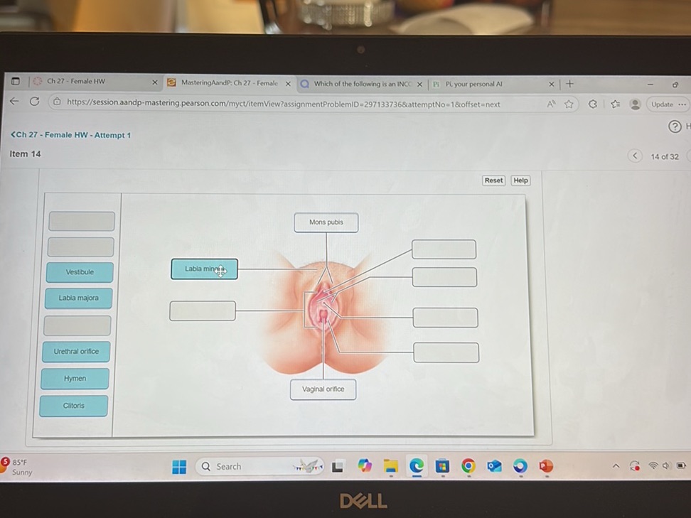The image shows a diagram of the female