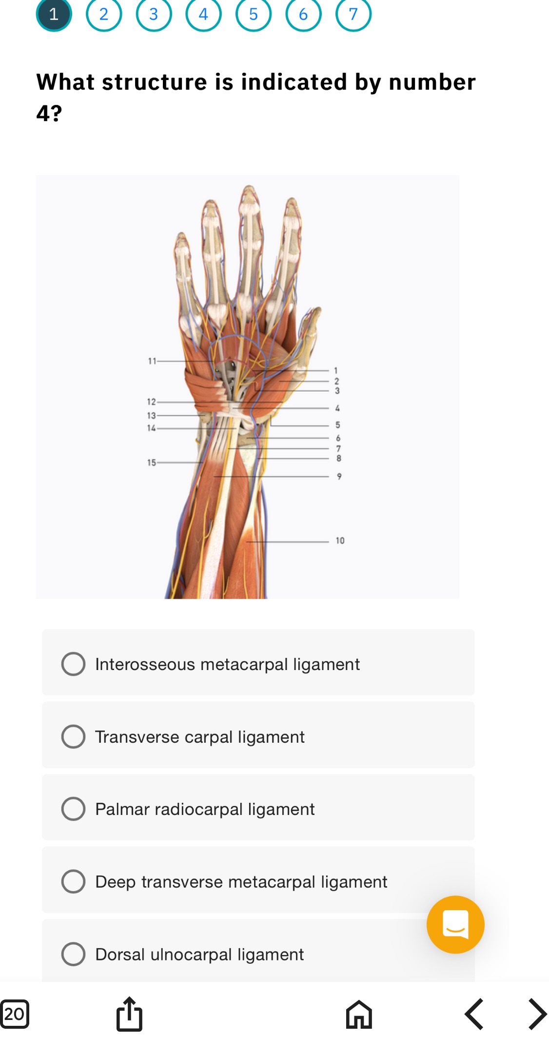 What structure is indicated by number 4? | StudyX