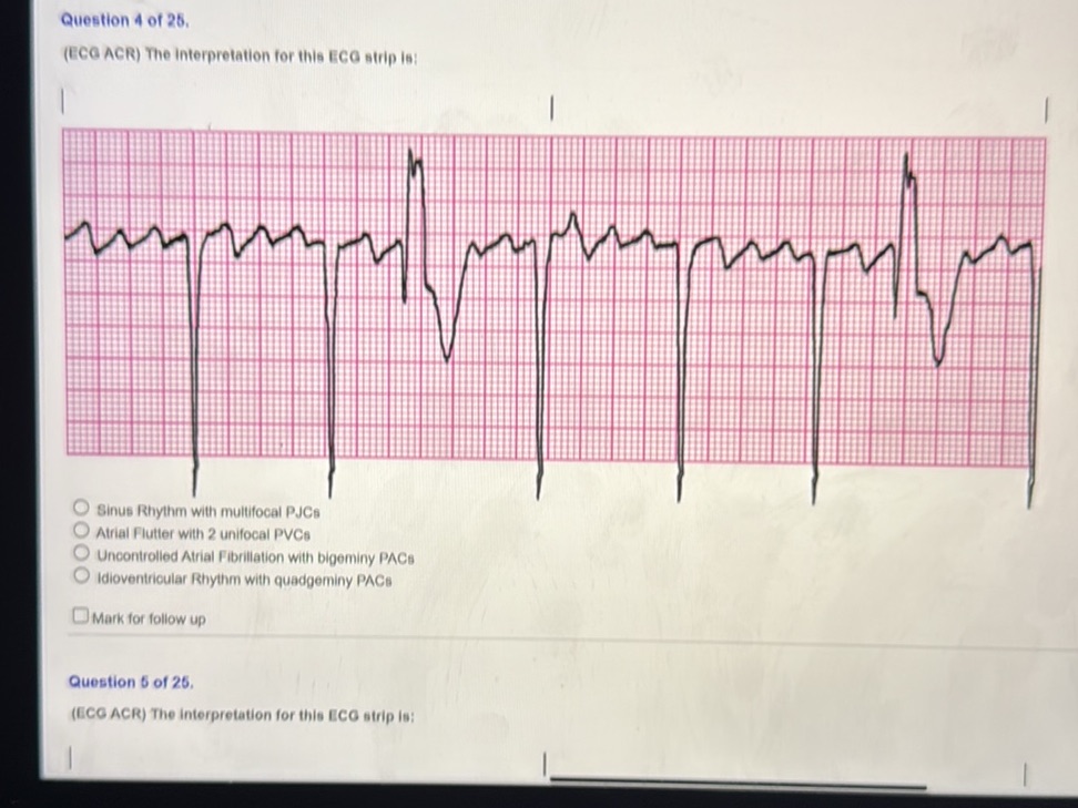 Question 4 of 25. (ECG ACR) The | StudyX