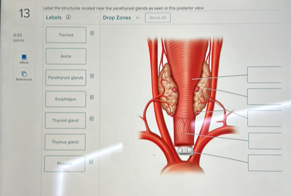 Parathyroid Label Label the structures located near the | StudyX