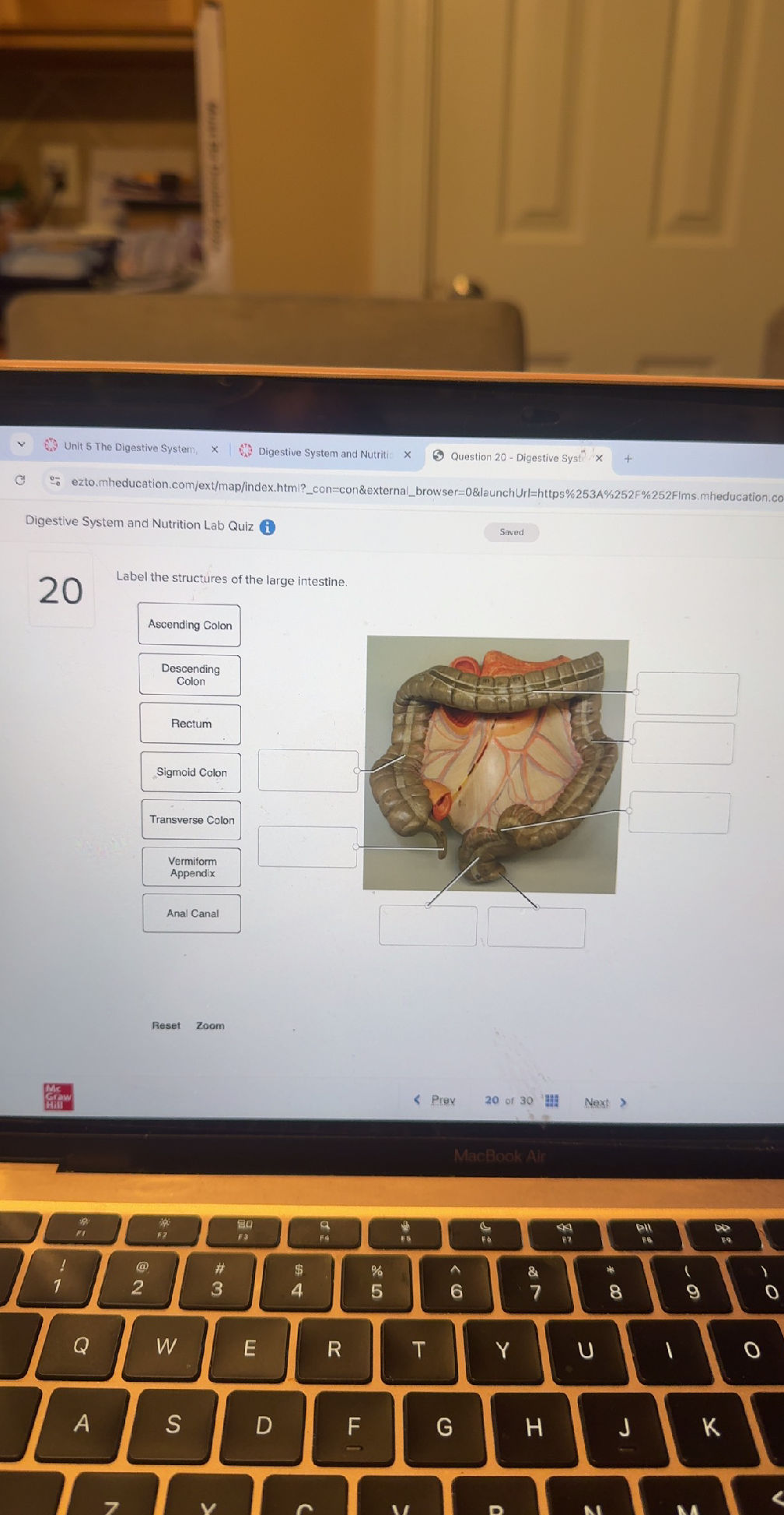 Label the structures of the large intestine.