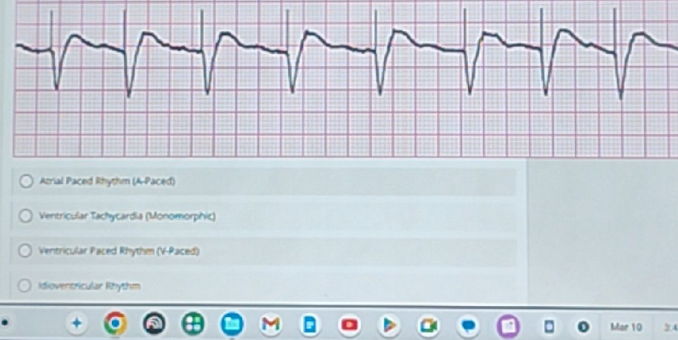 What type of cardiac rhythm is shown in the