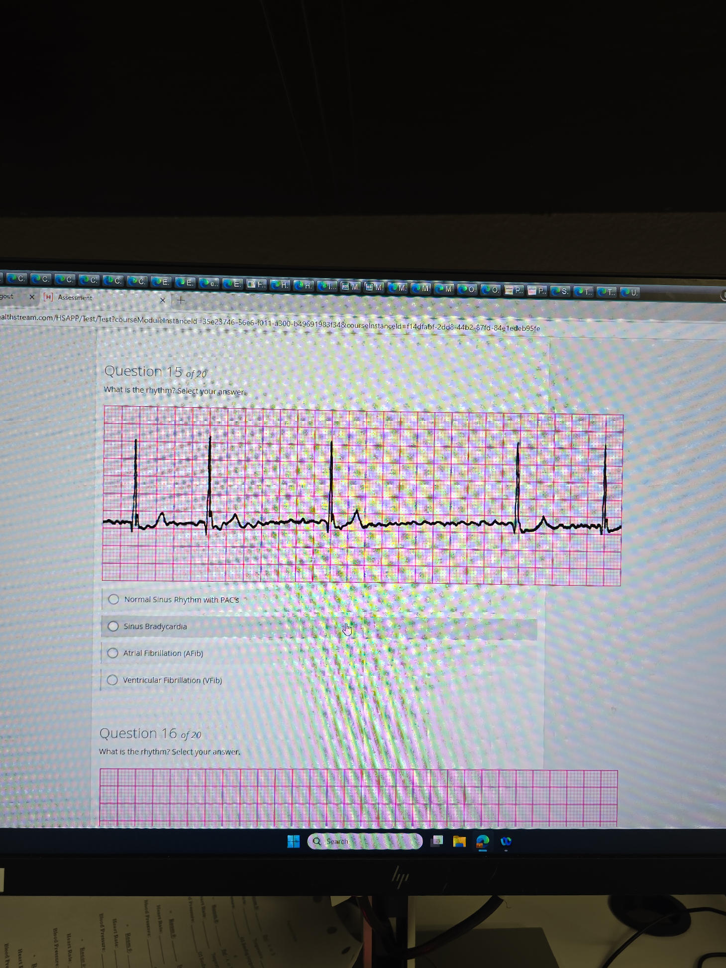 Question 15 of 20 What is the rhythm? Select | StudyX