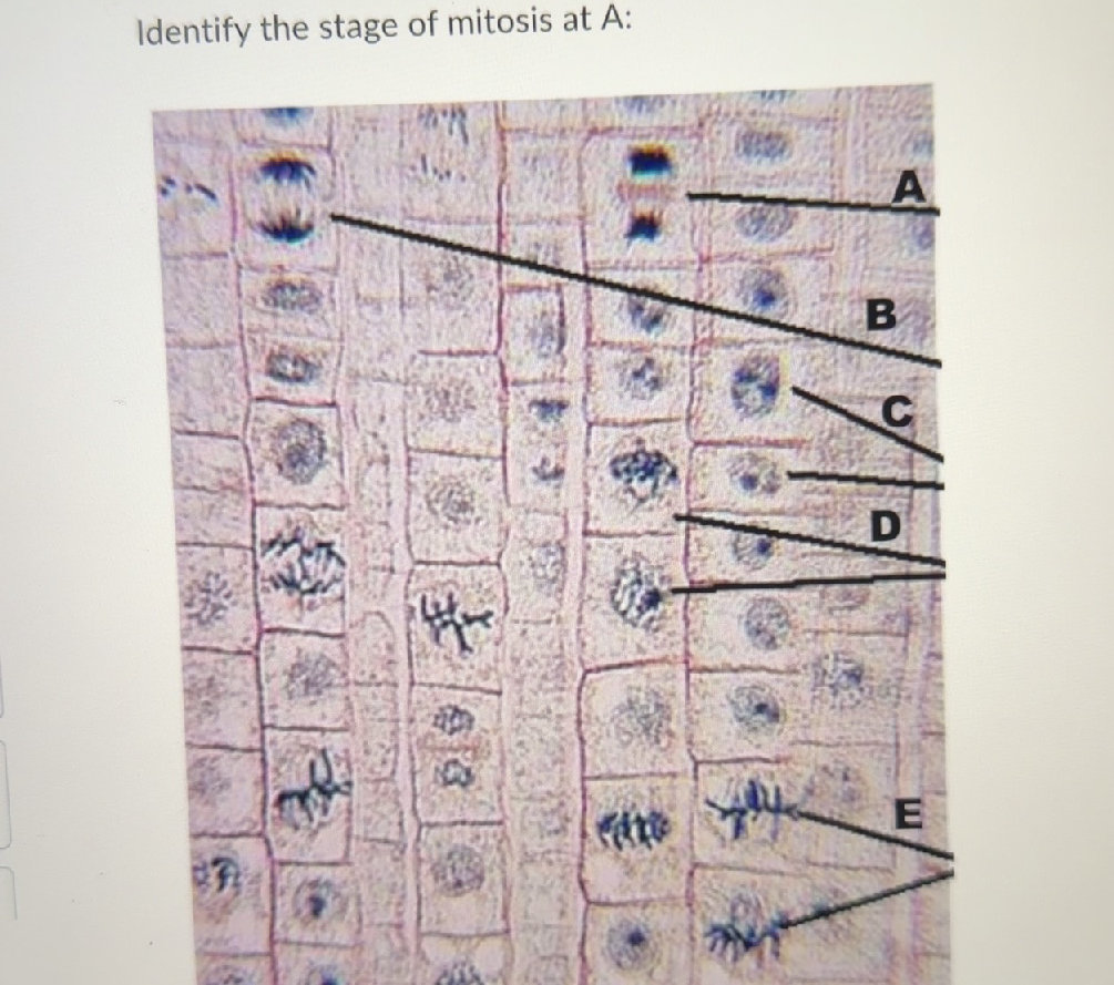 Identify the stage of mitosis at A | StudyX