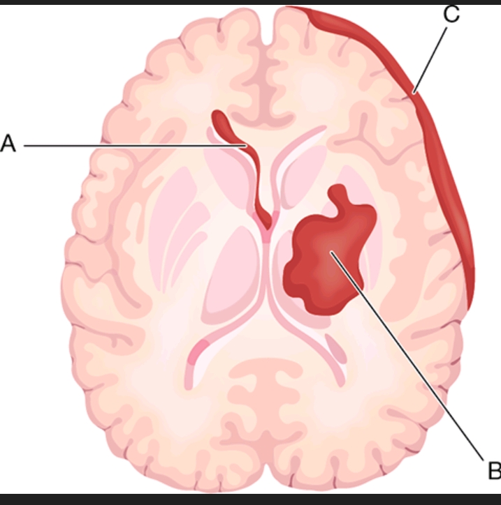 Identify the structures labeled A B and C in