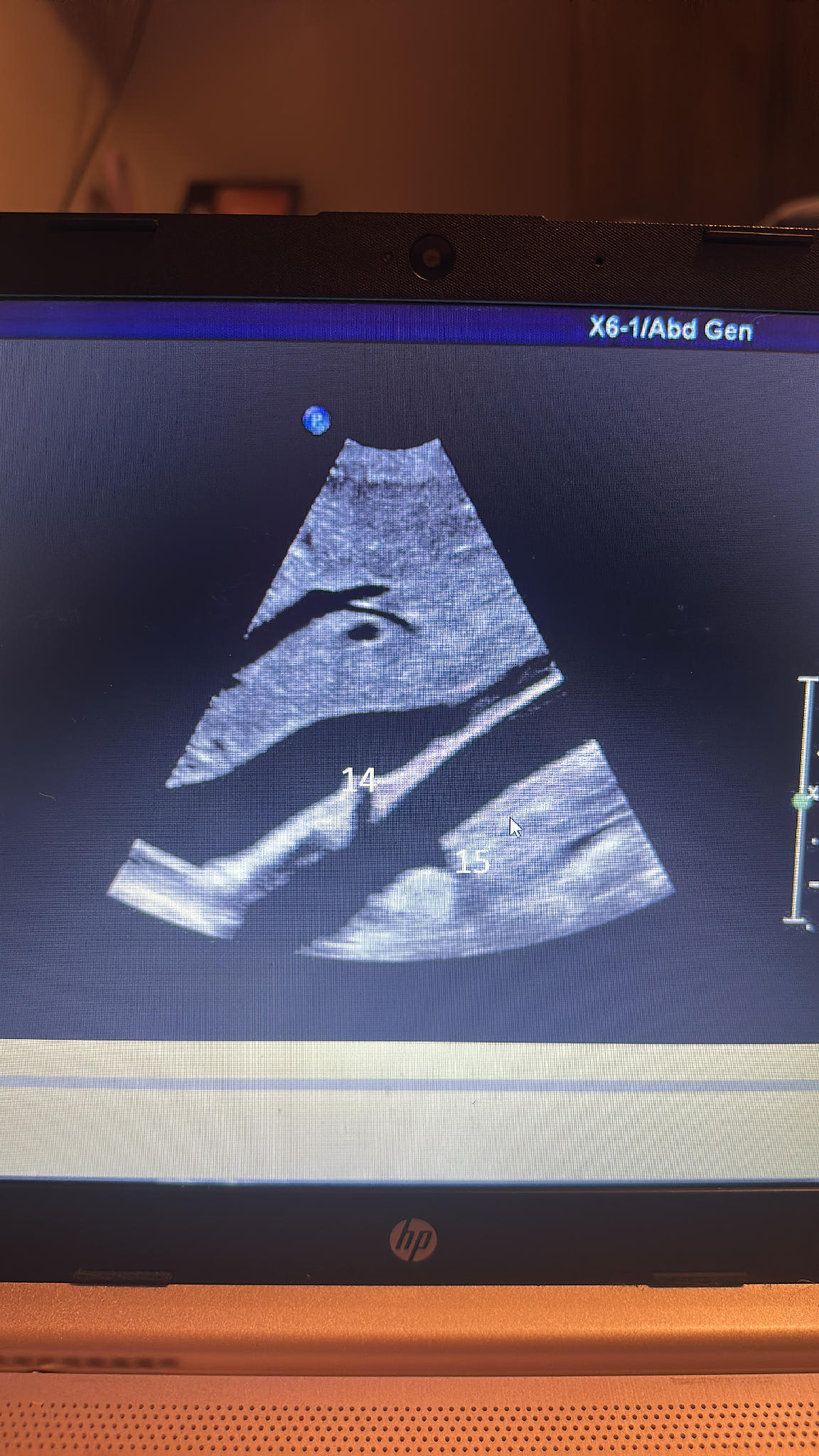 The image provided is a medical ultrasound | StudyX