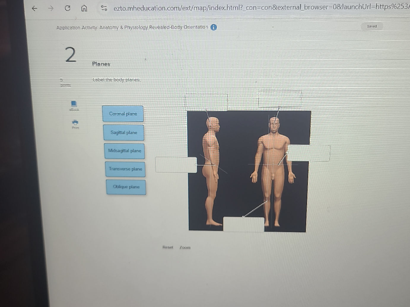 Application Activity: Anatomy Physiology | StudyX