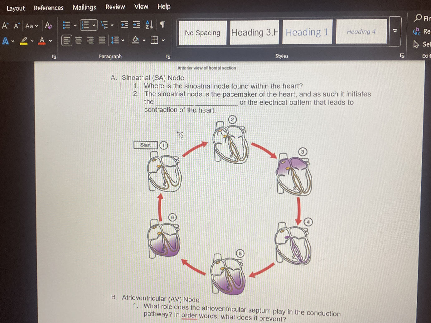 A. Sinoatrial (SA) Node 1. Where is the | StudyX