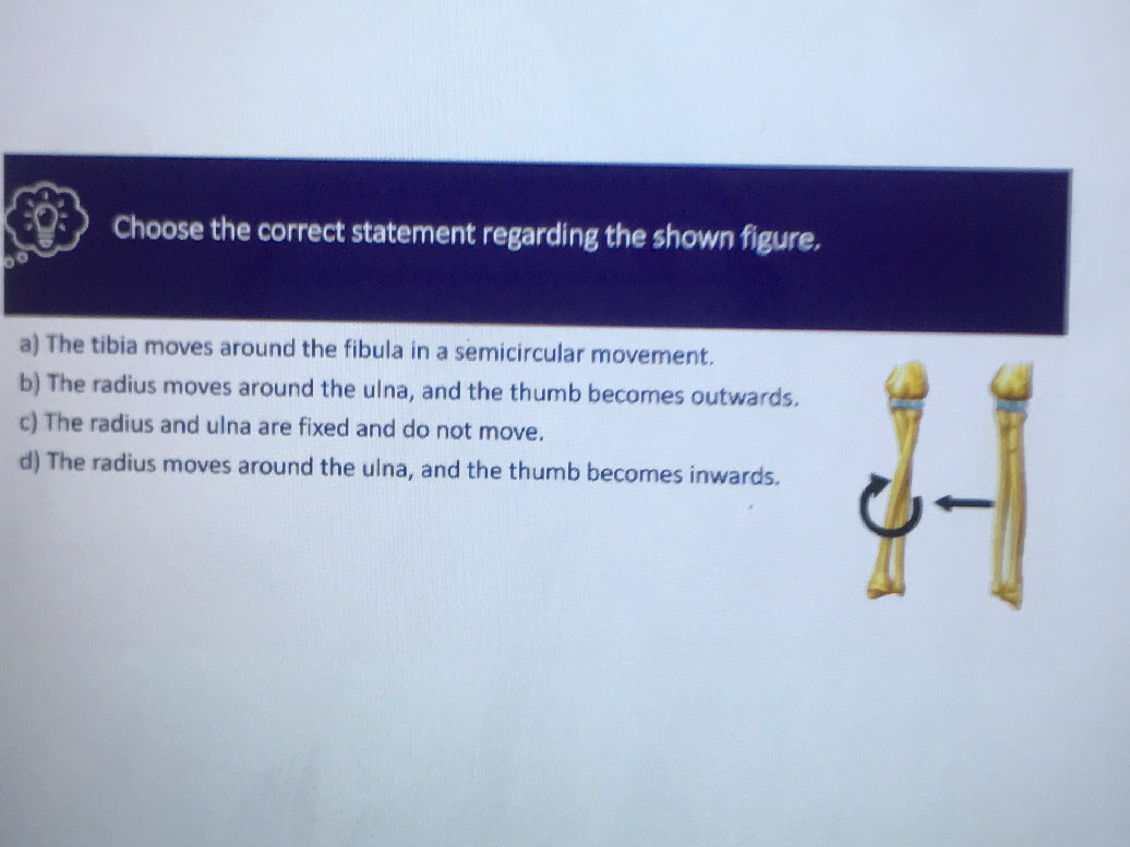 Choose the correct statement regarding the | StudyX
