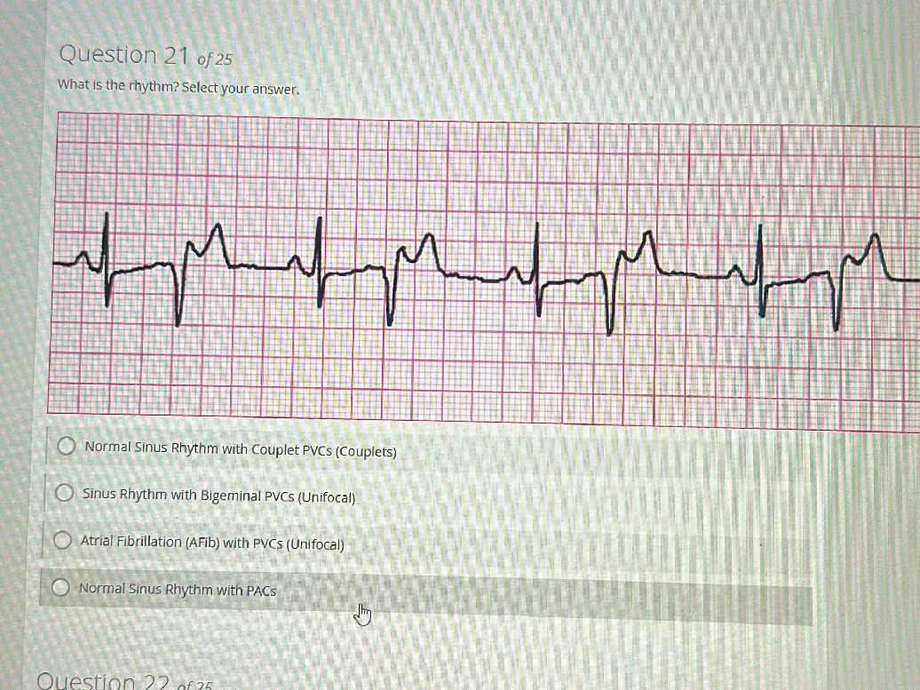 Question 21 of 25 What is the rhythm? Select | StudyX