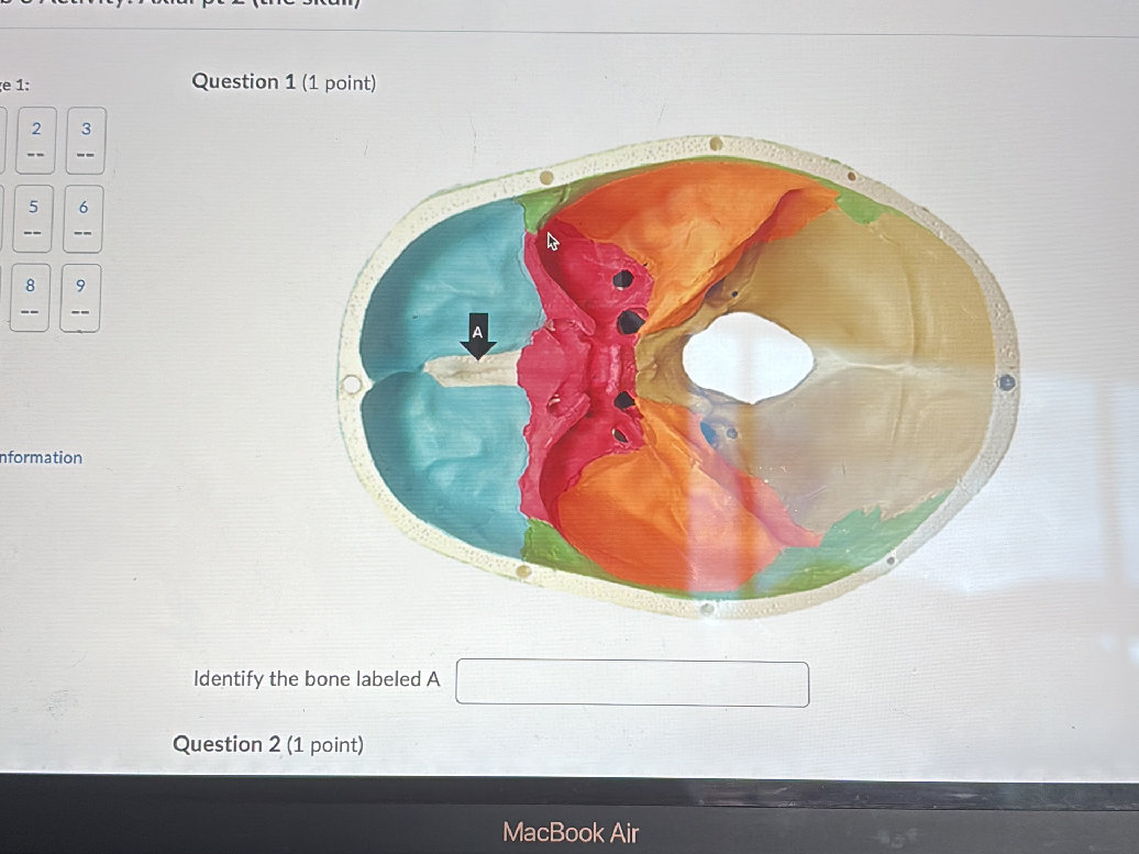Specific Bone Features Question 1 (1 point) Identify the bone | StudyX