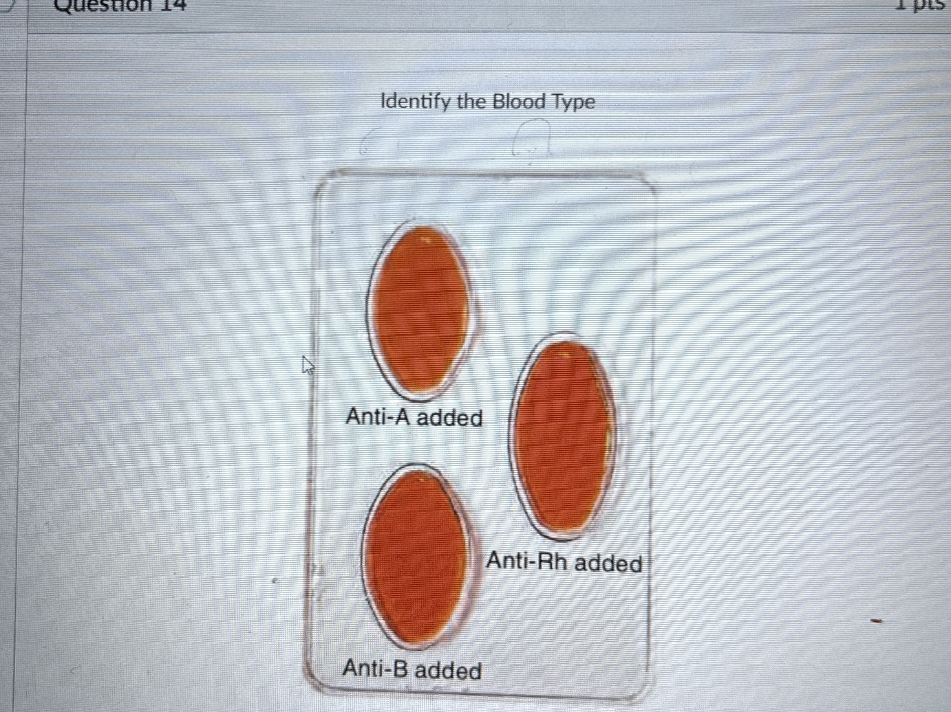 Anti Rashda B Identify the Blood Type Anti-A added | StudyX
