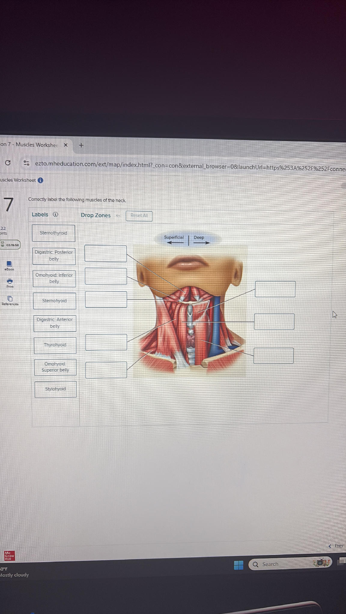 Correctly label the following muscles of the | StudyX