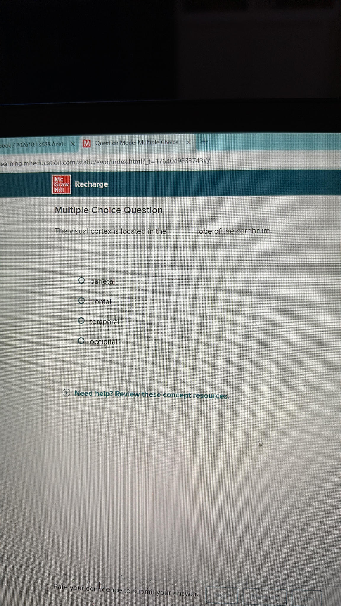 The visual cortex is located in the ________ | StudyX