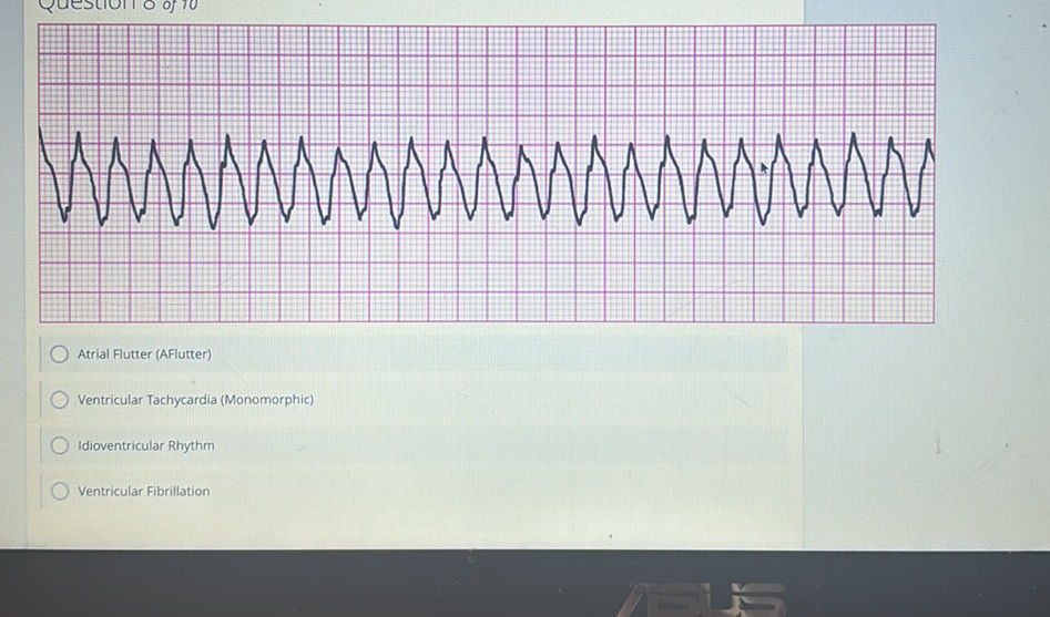 Question 8 of 10 Atrial Flutter (AFlutter) | StudyX