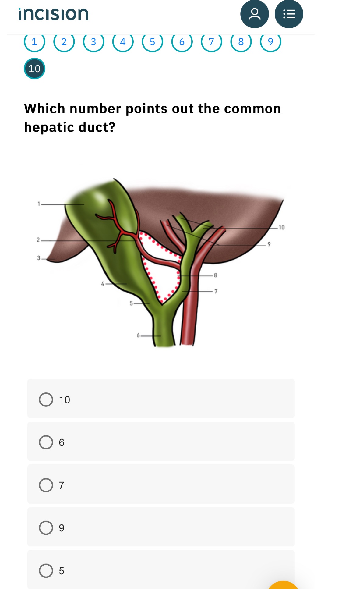 Which number points out the common hepatic | StudyX