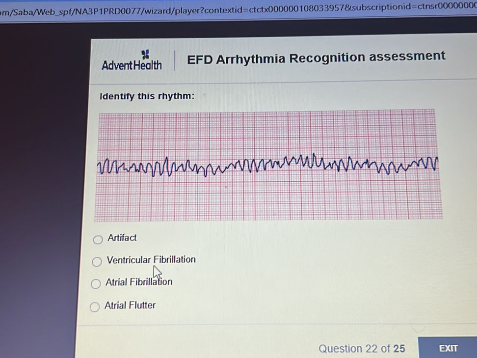 Identify this rhythm: Artifact Ventricular