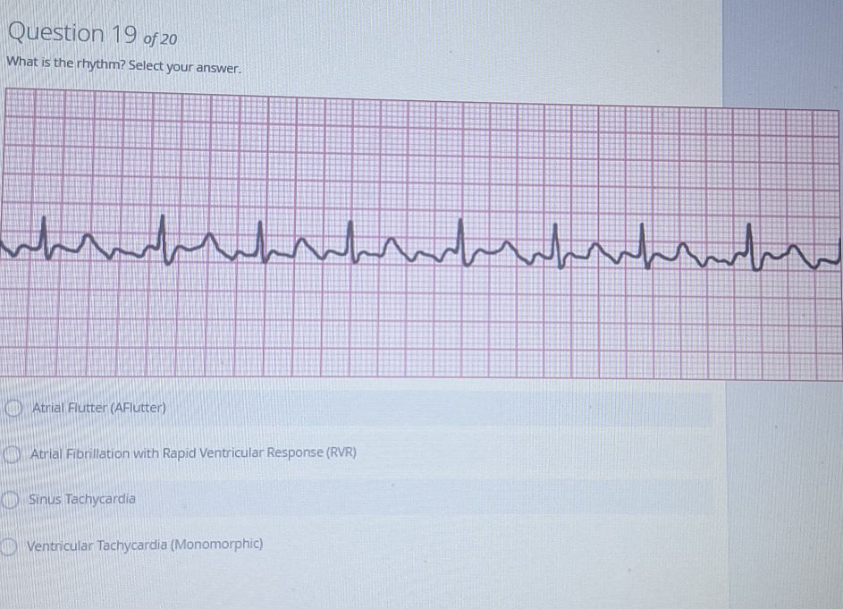 What is the rhythm? Select your answer.