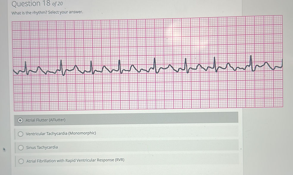 Question 18 of 20 What is the rhythm? Select | StudyX