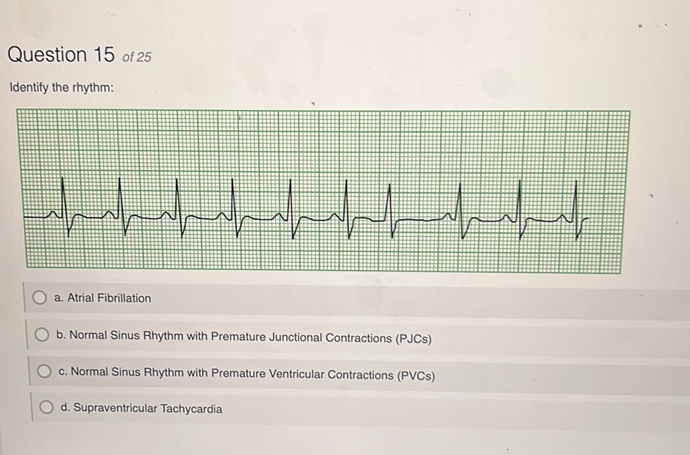 Question 15 of 25 Identify the rhythm: a. | StudyX