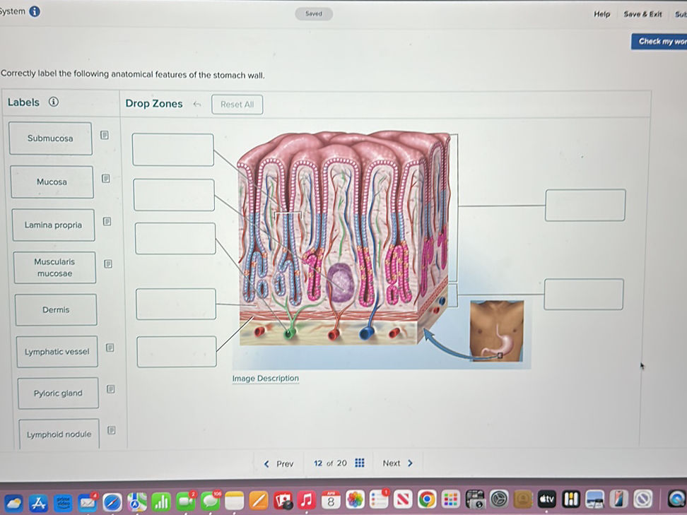 Correctly label the following anatomical
