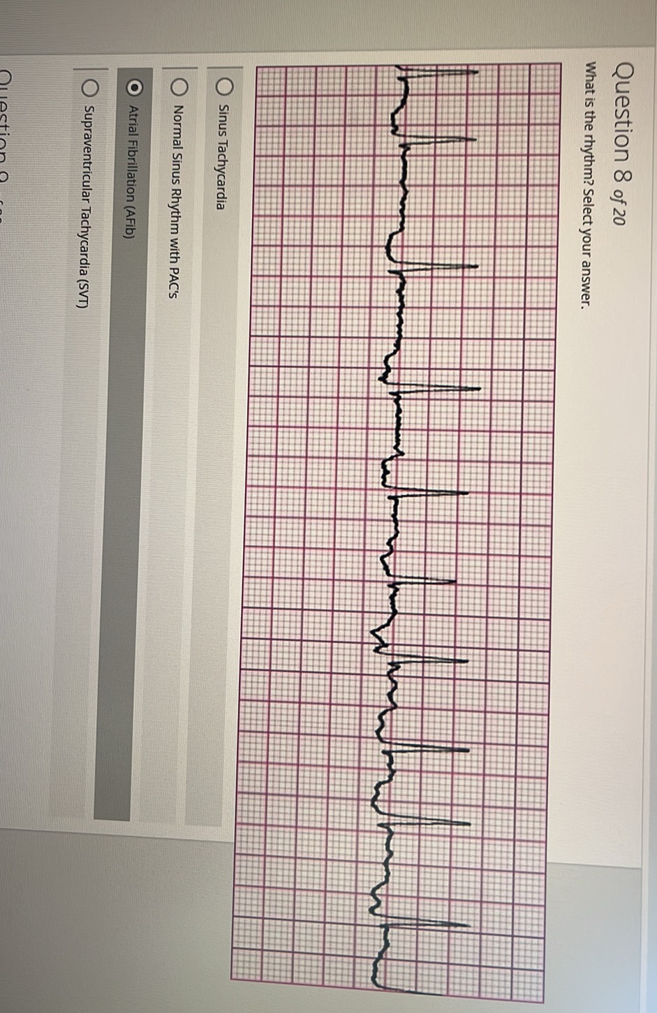 Question 8 of 20 What is the rhythm? Select | StudyX