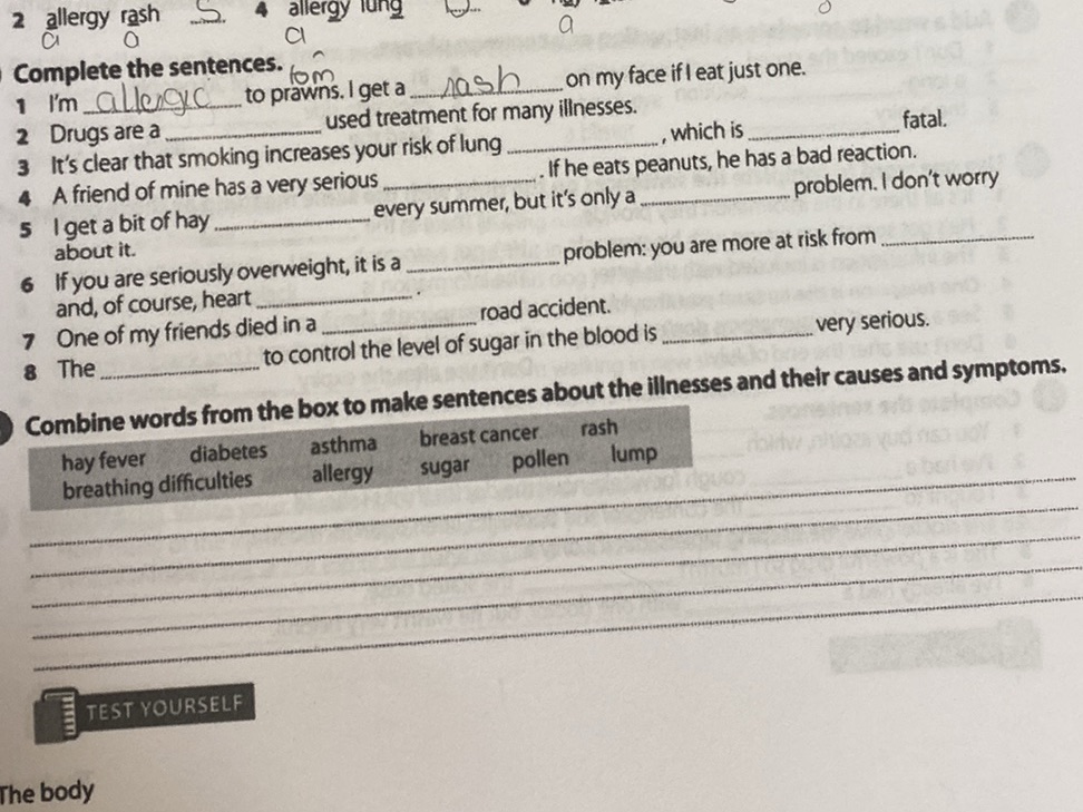 Complete the sentences. 1. I'm allergic to | StudyX