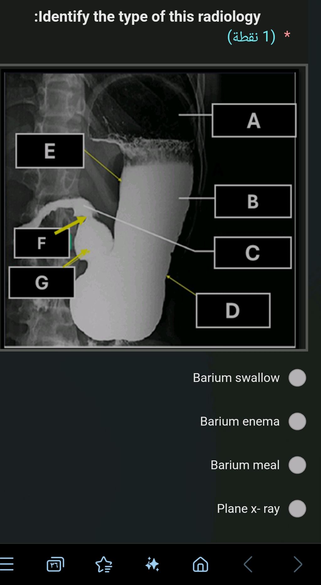 Identify the type of this radiology Barium | StudyX