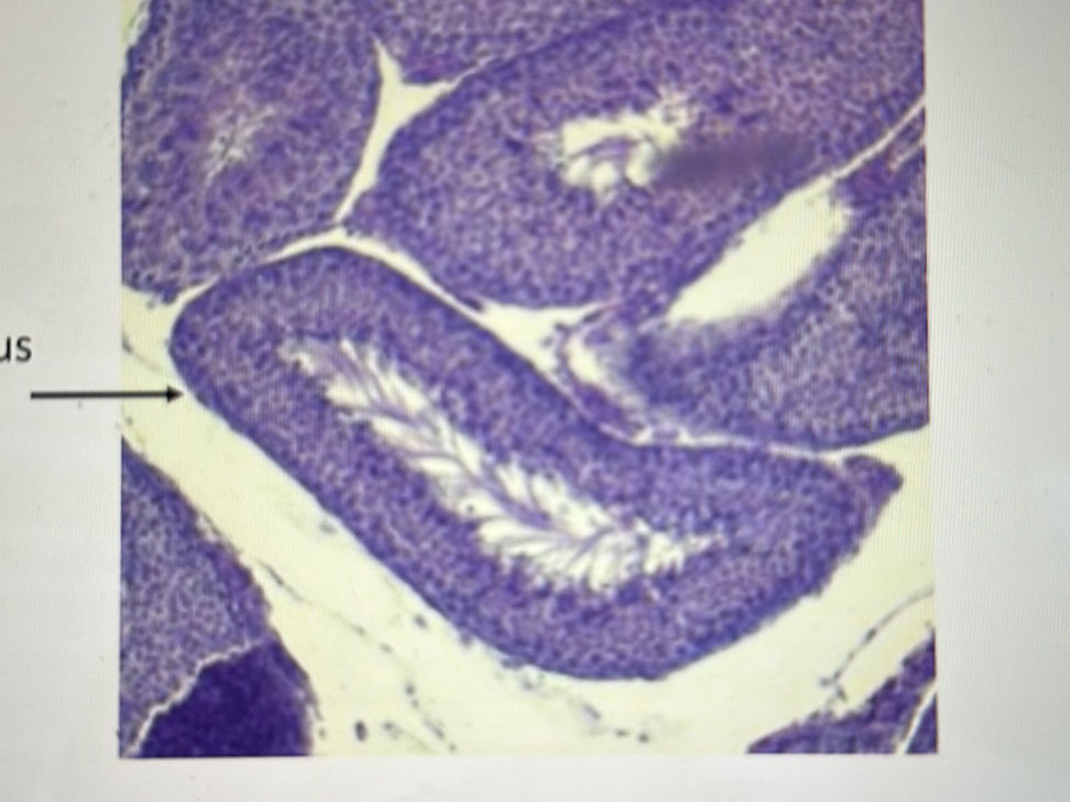 What type of cell did you locate outside of