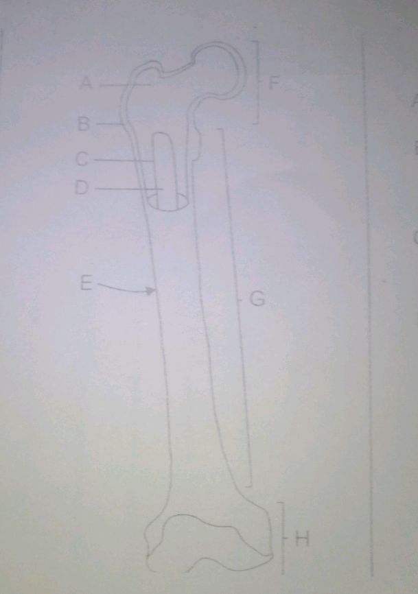 The image shows a diagram of a bone with | StudyX